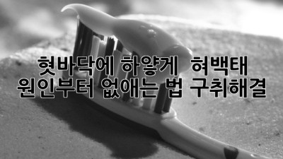 혓바닥에 하얗게? 👅 혀백태 원인부터 없애는 법! #구취해결